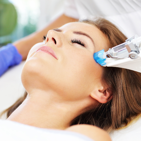 micro-needling ave esthetique hoeksche waard oud-beijerland