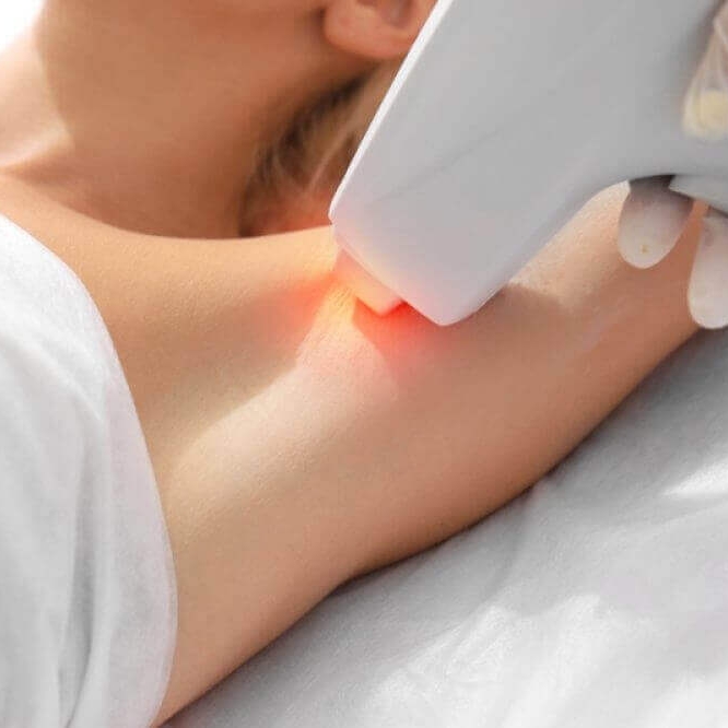 RF-ST forma system ave esthetique oud-beijerland