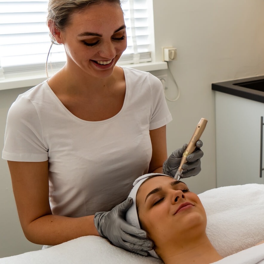 micro needling